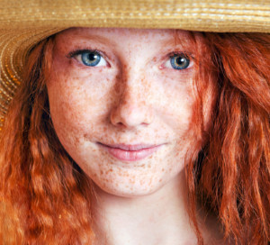 Redhead